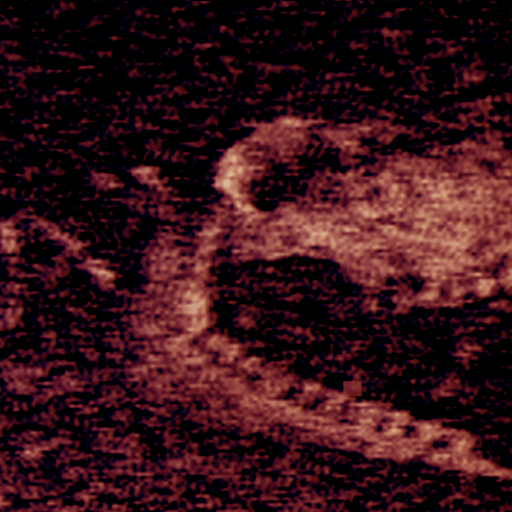Iron Lung icon